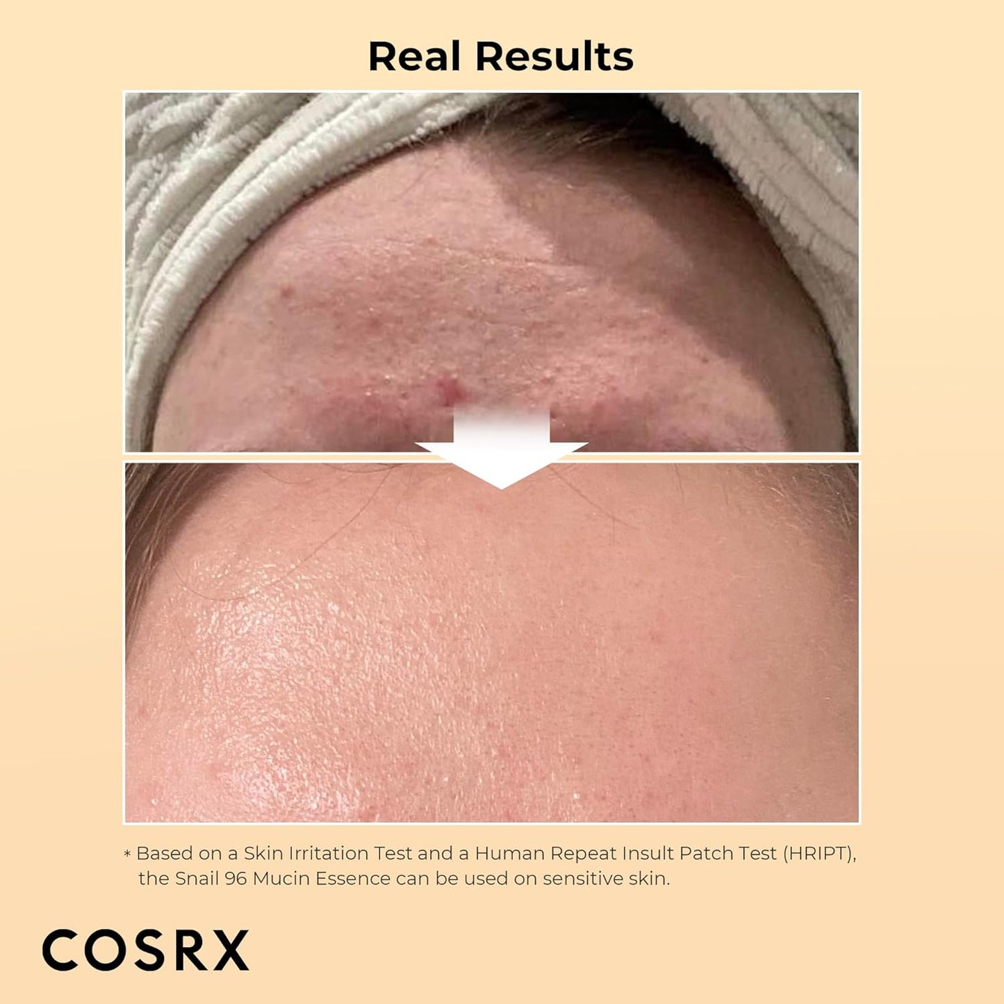 COSRX Snail 96 Essence - Hydrate & Repair