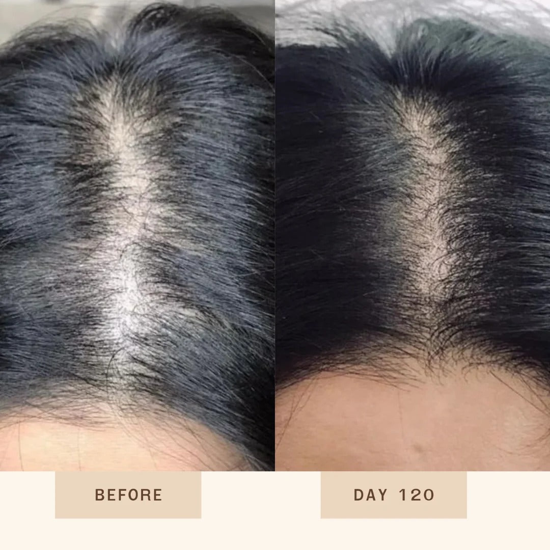 Proskire Anti-Grey Hair Serum