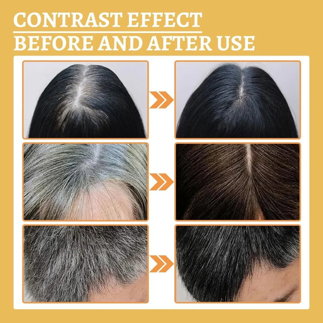 Proskire Anti-Grey Hair Serum