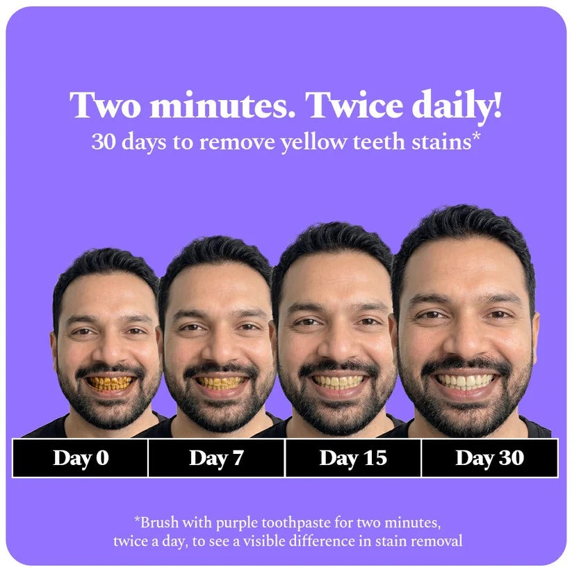 Perfora | Magic Whitening Toothpaste