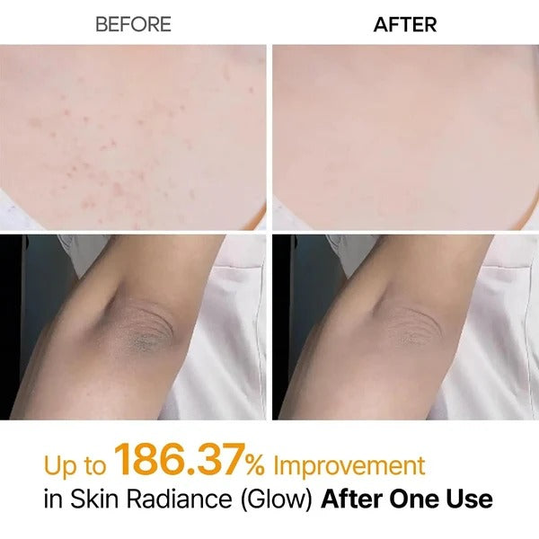Dr. Melaxin Peel Shot Body Spray – For Dark Spots & Rough Skin