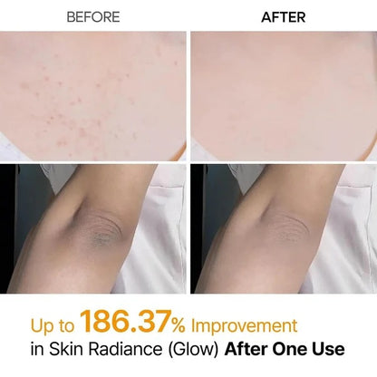 Dr. Melaxin Peel Shot Body Spray – For Dark Spots & Rough Skin
