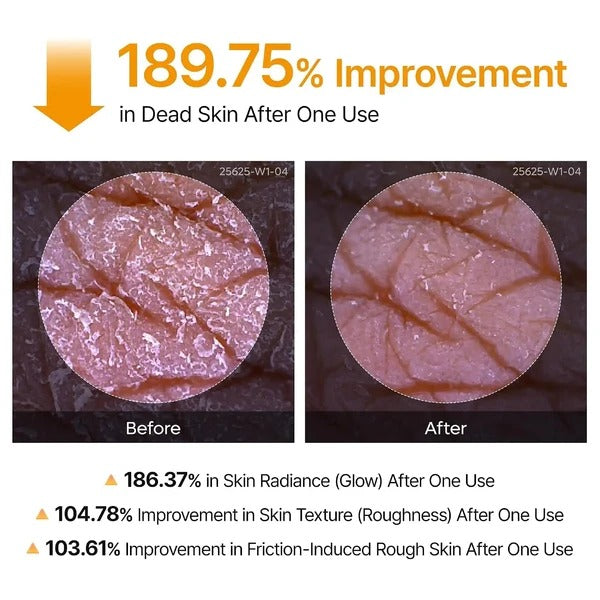 Dr. Melaxin Peel Shot Body Spray – For Dark Spots & Rough Skin