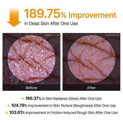 Dr. Melaxin Peel Shot Body Spray – For Dark Spots & Rough Skin