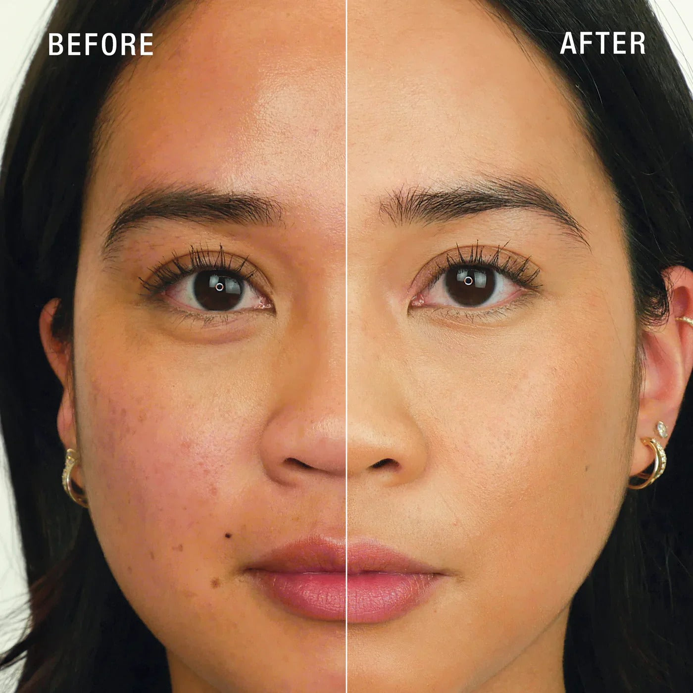 Teashell Niacinamide Brightening Serum | Fade Dark Spots, Acne Marks & Even Skin Tone