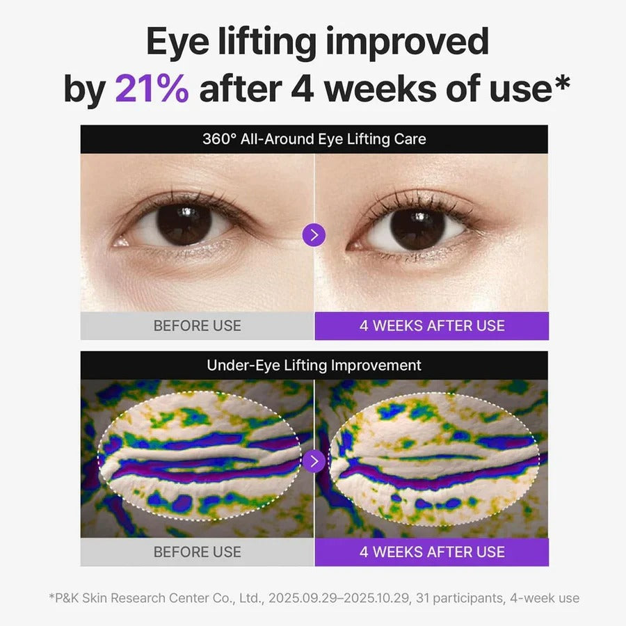 Buy 1 Get 1 FREE | 360° Shot PDRN Lifting Eye Cream | Retinol & Collagen | Anti Aging Eye Cream |