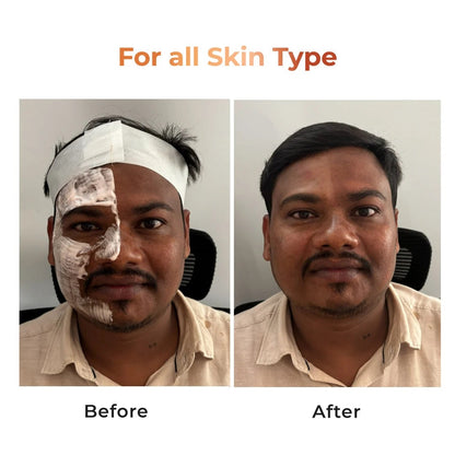 Niconi Tan Vanish Gluta-Kojic Skin Polish